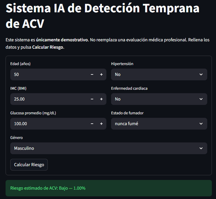 Vista previa de Sistema de IA para detección temprana de ACV